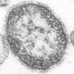 Public Health warns of possible recent measles exposure at Sea-Tac Airport